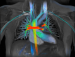 Webinar: Deep Learning-Based Image Reconstruction for MRI 9
